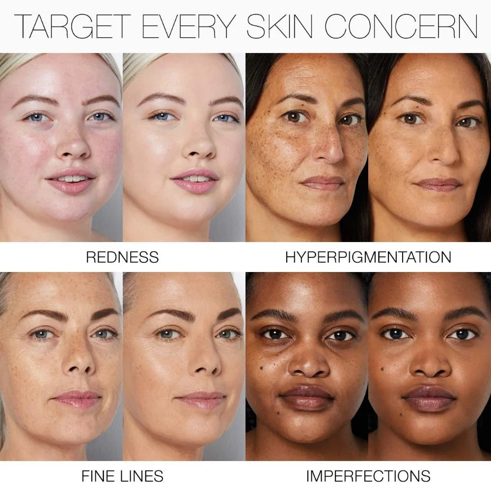 NARS Foundation Liquid Medium Coverage Natural Finish Skincare-infused Long Lasting Breathable Foundation For Sensitive Skin