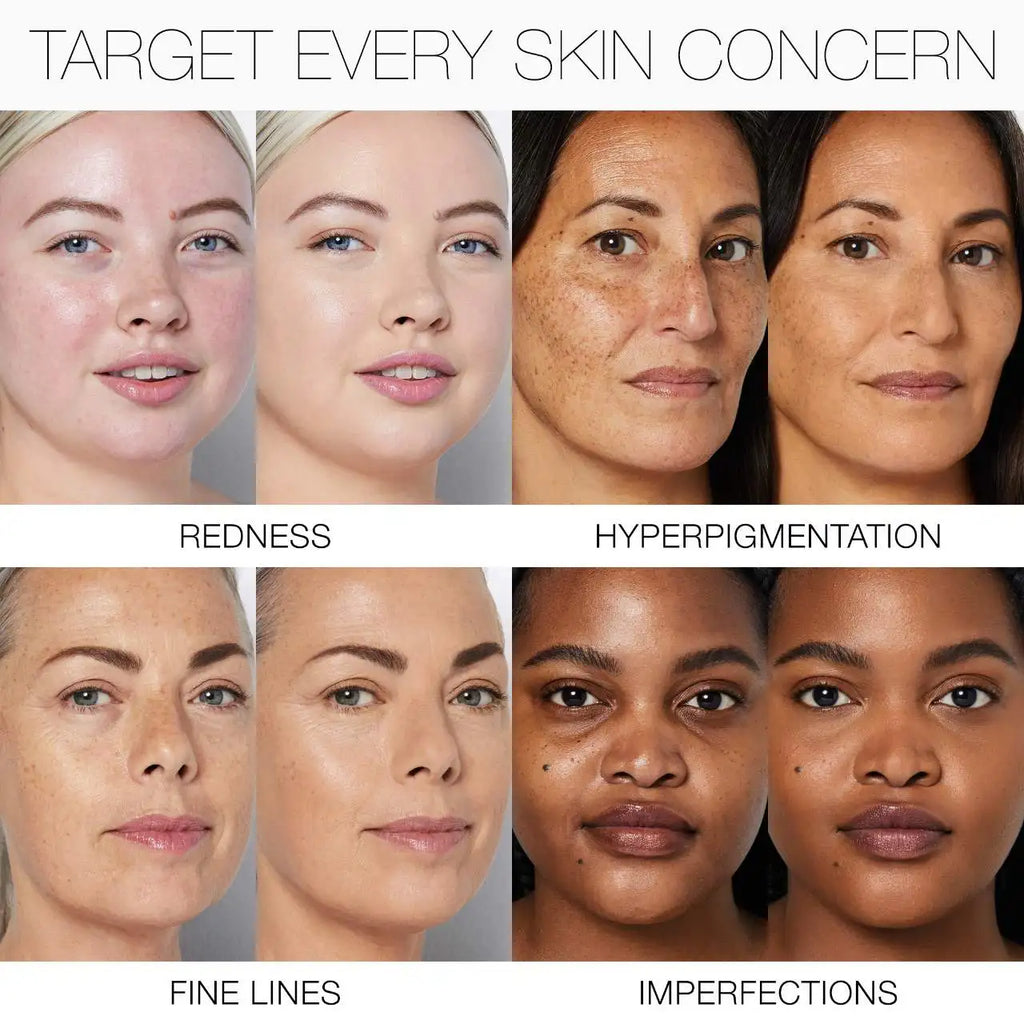 NARS Foundation Liquid Medium Coverage Natural Finish Skincare-infused Long Lasting Breathable Foundation For Sensitive Skin